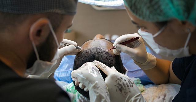 Hvad er de gennemsnitlige priser på hårtransplantationer i Europa?